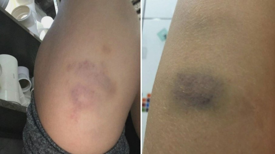 Adolescente de 16 anos é suspeito de estuprar cunhada e agredir namorada em Corumbá de Goiás