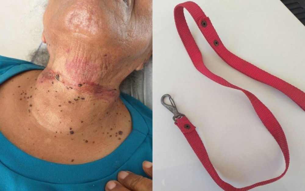 Idosa é assaltada e enforcada com coleira, em Senador Canedo
