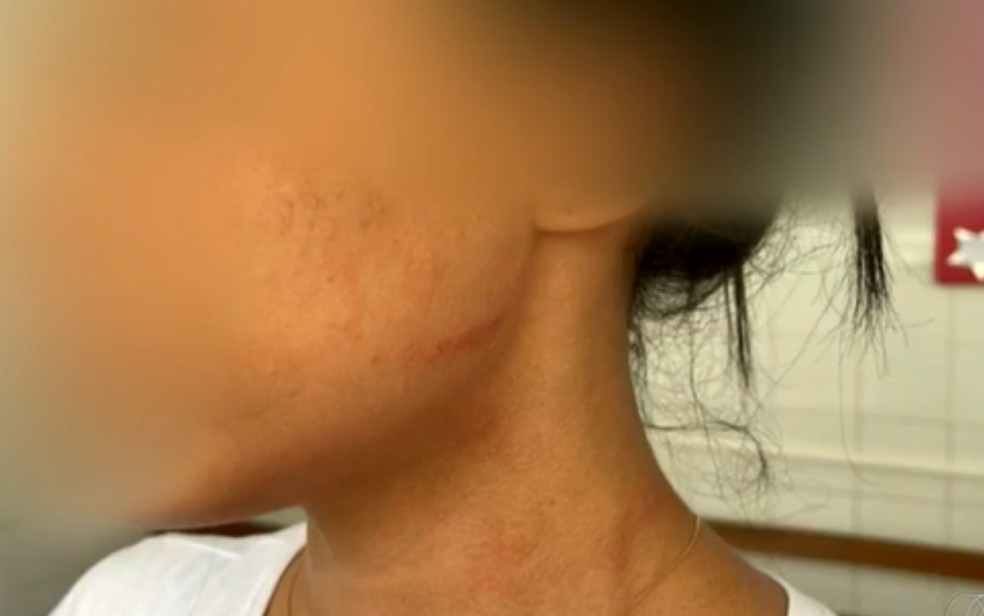 Médicas são agredidas por acompanhante que se recusou a usar máscara