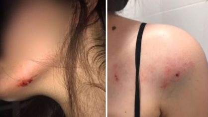 Bahia: Adolescente de 16 anos é agredida pelo ex-namorado