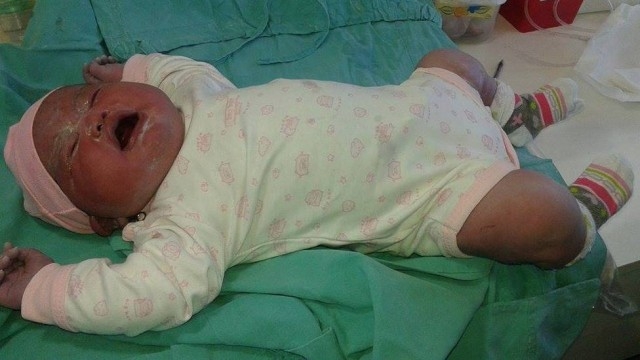 Superbebê argentina nasce com mais de 6kg e surpreende médicos