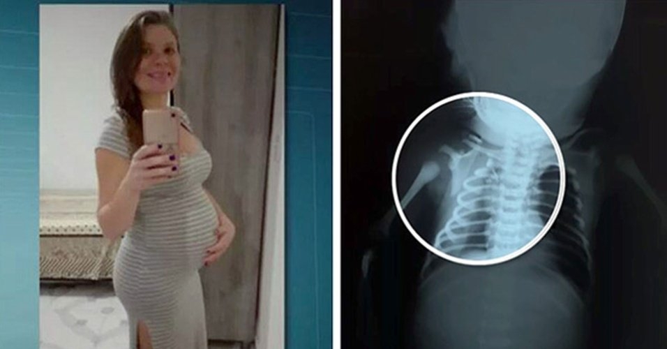 MP denuncia homem por morte de bebê baleado dentro da barriga da mãe