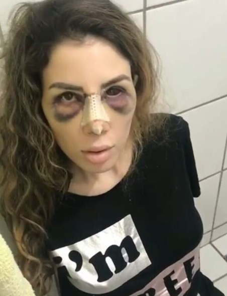 Empresário de Camilla Uckers revela que ela está depressiva e não tem se alimentado