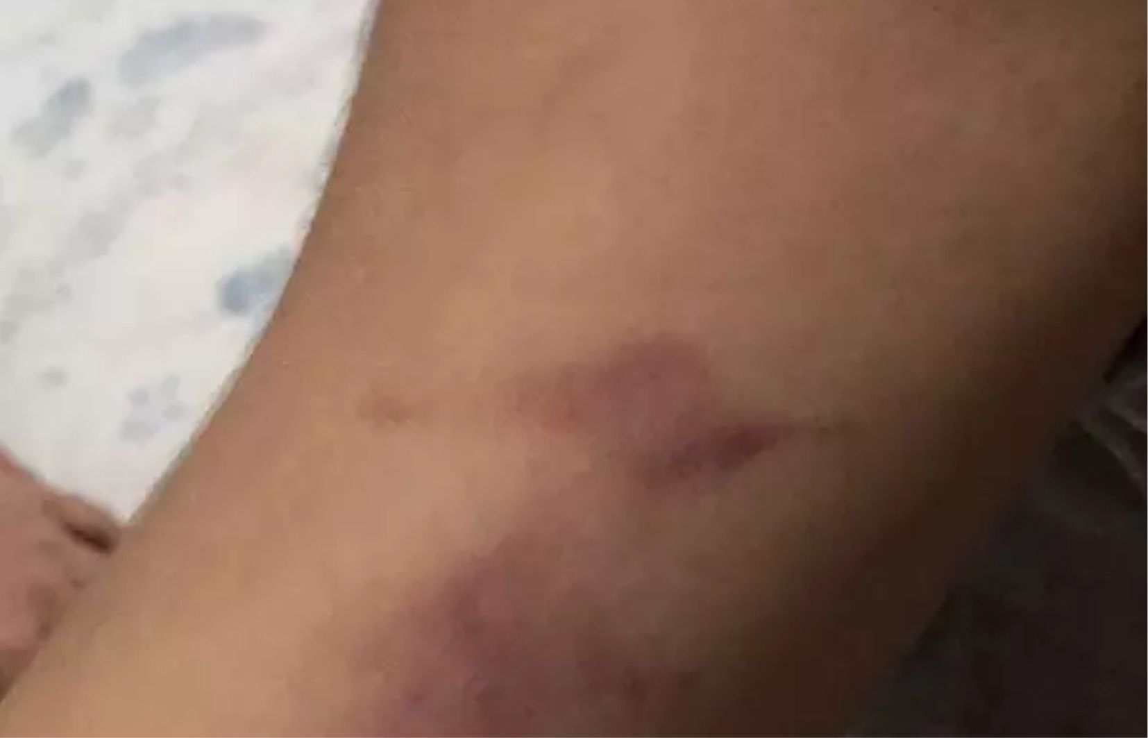 Psicóloga é presa suspeita de agredir criança autista