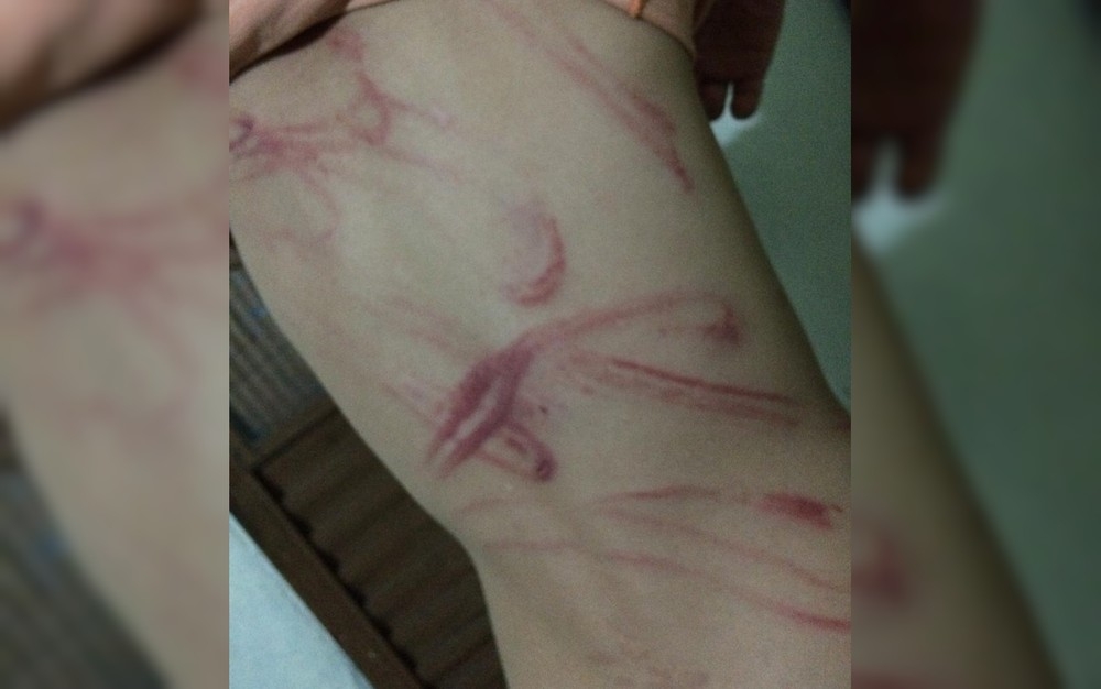 Pai é preso por espancar filho em Goiânia