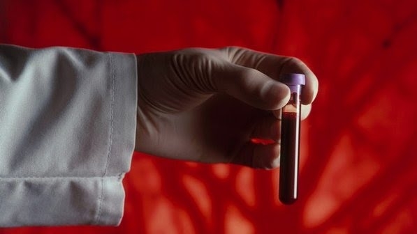 Laboratório de Goiânia pode realizar exames de zika na próxima segunda-feira