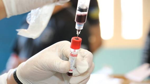 Procon Goiás encontra variação de 137,04% em exames para Covid-19