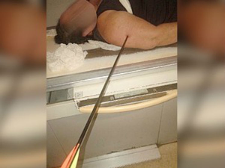Mulher leva flechada dentro de ônibus no Pará