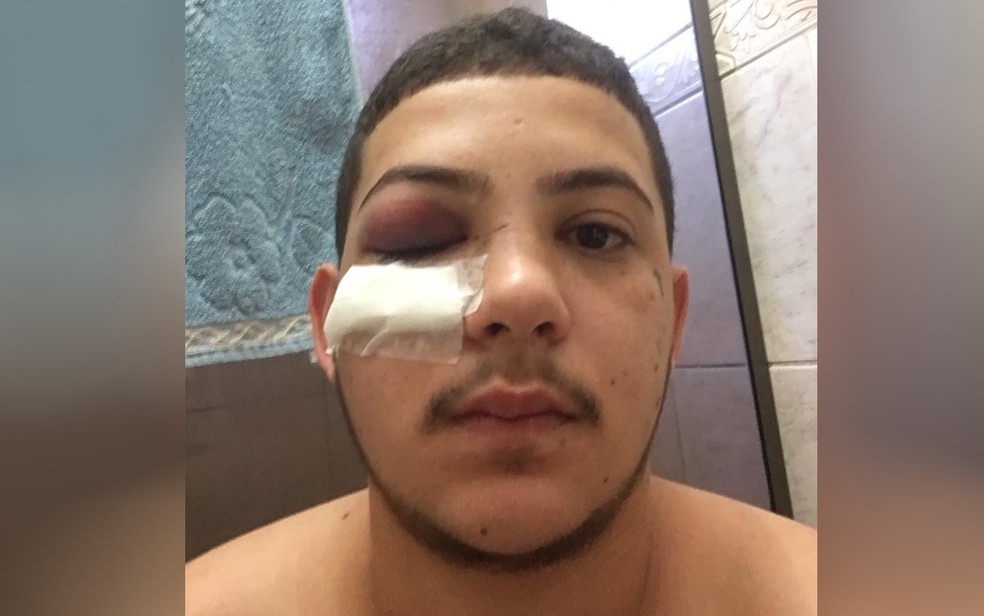Jovem denuncia que foi agredido com socos por cantor sertanejo em Goiânia