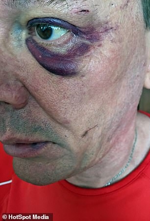 Homem é esfaqueado e agredido com frigideira incandescente por ex-namorada, na Inglaterra