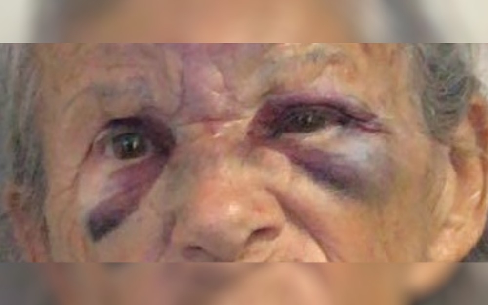 Jovem é preso suspeito de agredir idosa de 83 anos em Morrinhos