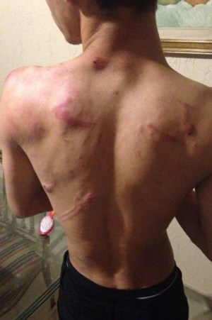 Jovem de 17 anos é agredido  pelo pai após assumir que era homossexual