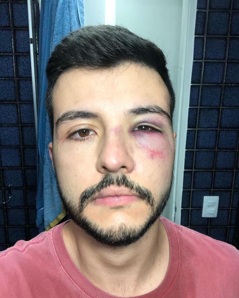 Matheus Ribeiro reage a assalto e deixa um alerta nas redes sociais.