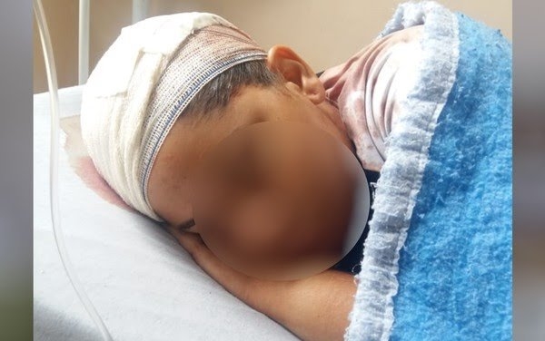 Homem agrediu ex-enteada por ciúmes, diz polícia