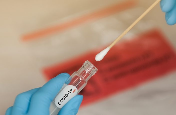 Planos de saúde são obrigados a oferecer exames rápidos para Covid – 19