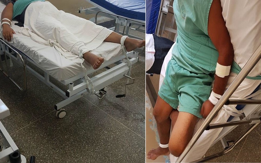 Peritos encontram pacientes amarrados em macas de hospital psiquiátrico
