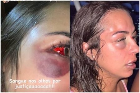 PC investiga agressão de três homens contra arquiteta no RJ
