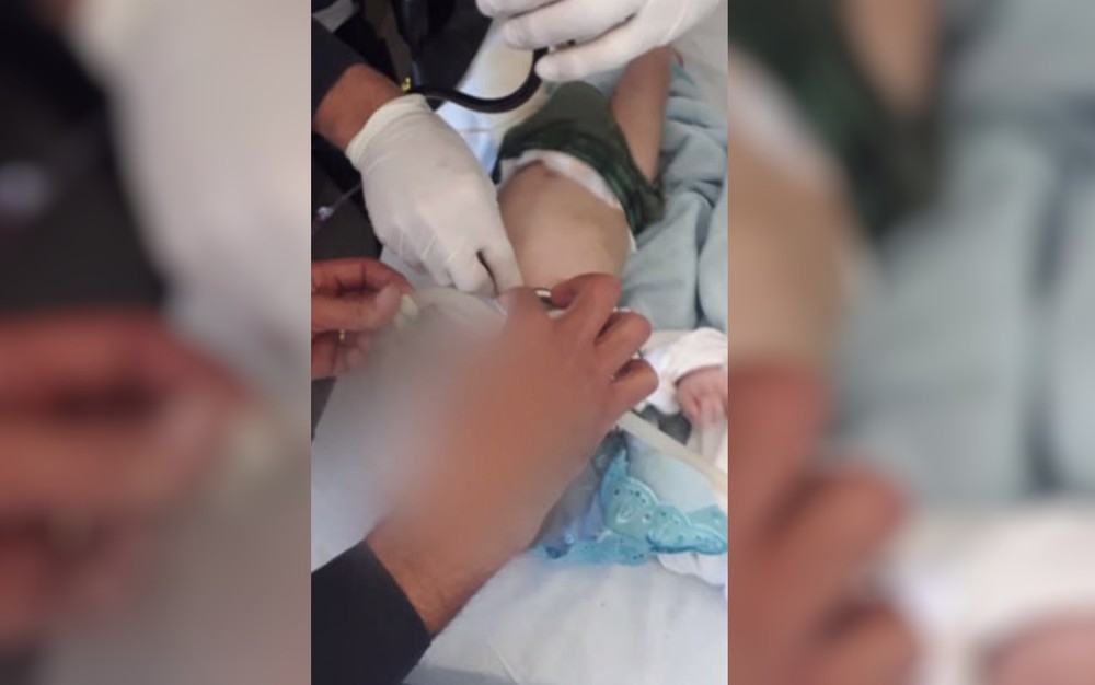 Polícia investiga se pais maltratavam bebê internado com perna quebrada e boca queimada em Goiânia