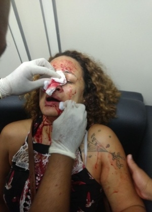 Anápolis: professora morre com Covid-19