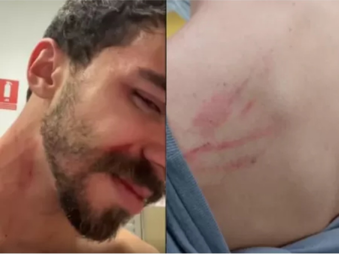 Ataque homofóbico em terminal de ônibus de São Paulo