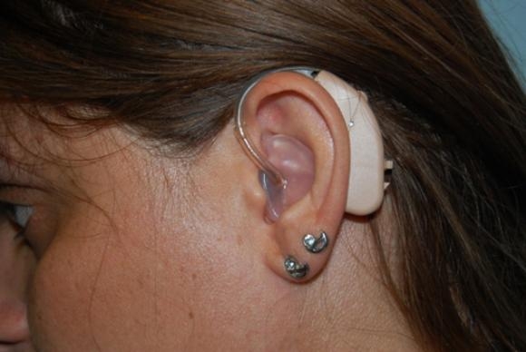 Jovens estão perdendo audição por causa de fones de ouvido, alerta conselho