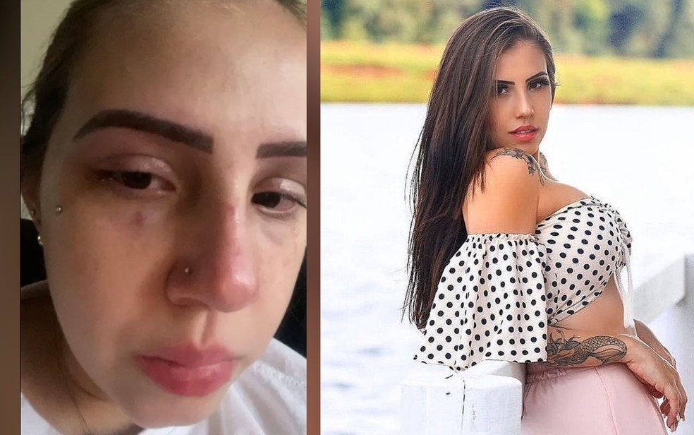 Blogueiras goianas denunciam nas redes sociais que foram agredidas por namorado