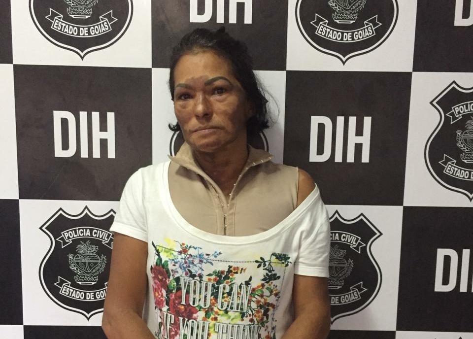 Mulher é presa suspeita de matar marido queimado