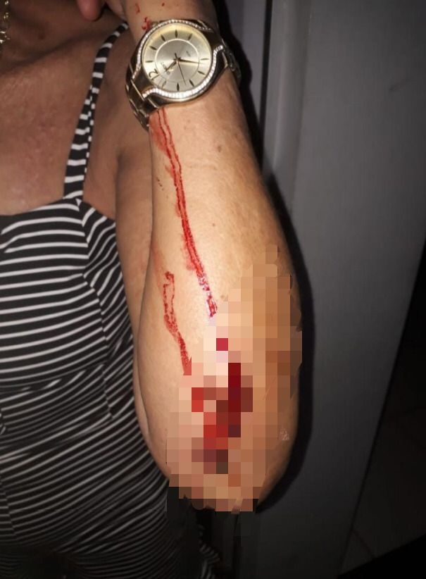 Homem é preso após agredir violentamente a companheira
