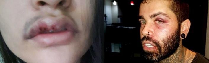 Cantor e esposa denunciam PM por agressão