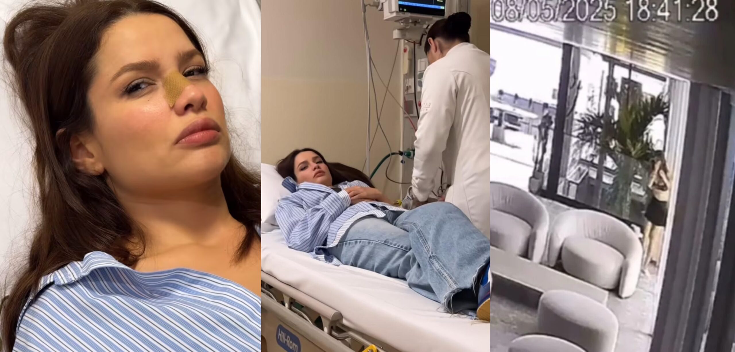 Juliette fratura o nariz após bater rosto em porta de vidro; assista