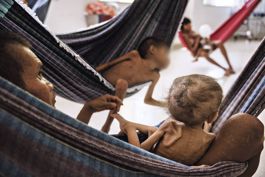 Morte de bebê indígena por desnutrição em MT gera cobrança ao governo Lula