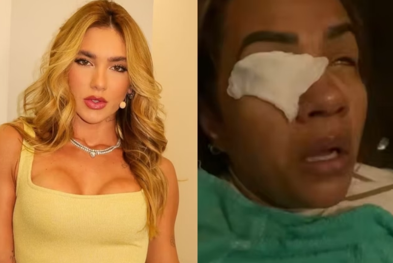 Mulher alega ter ficado cega após usar produto de Virginia Fonseca; WePink vira alvo de processo