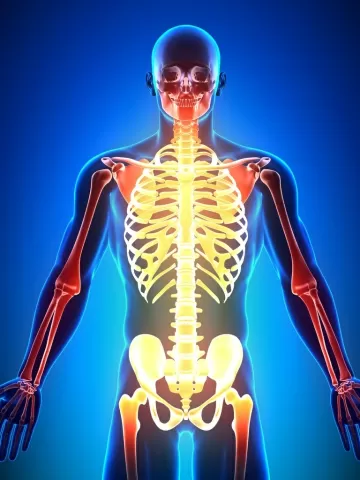 Fibromialgia é oficialmente reconhecida como deficiência no Brasil