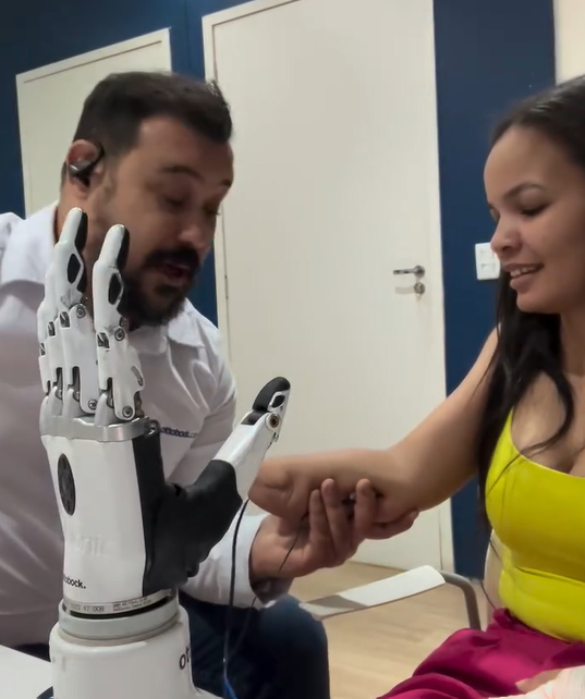 Superação: mulher que teve braço decepado recupera esperança com prótese mecânica