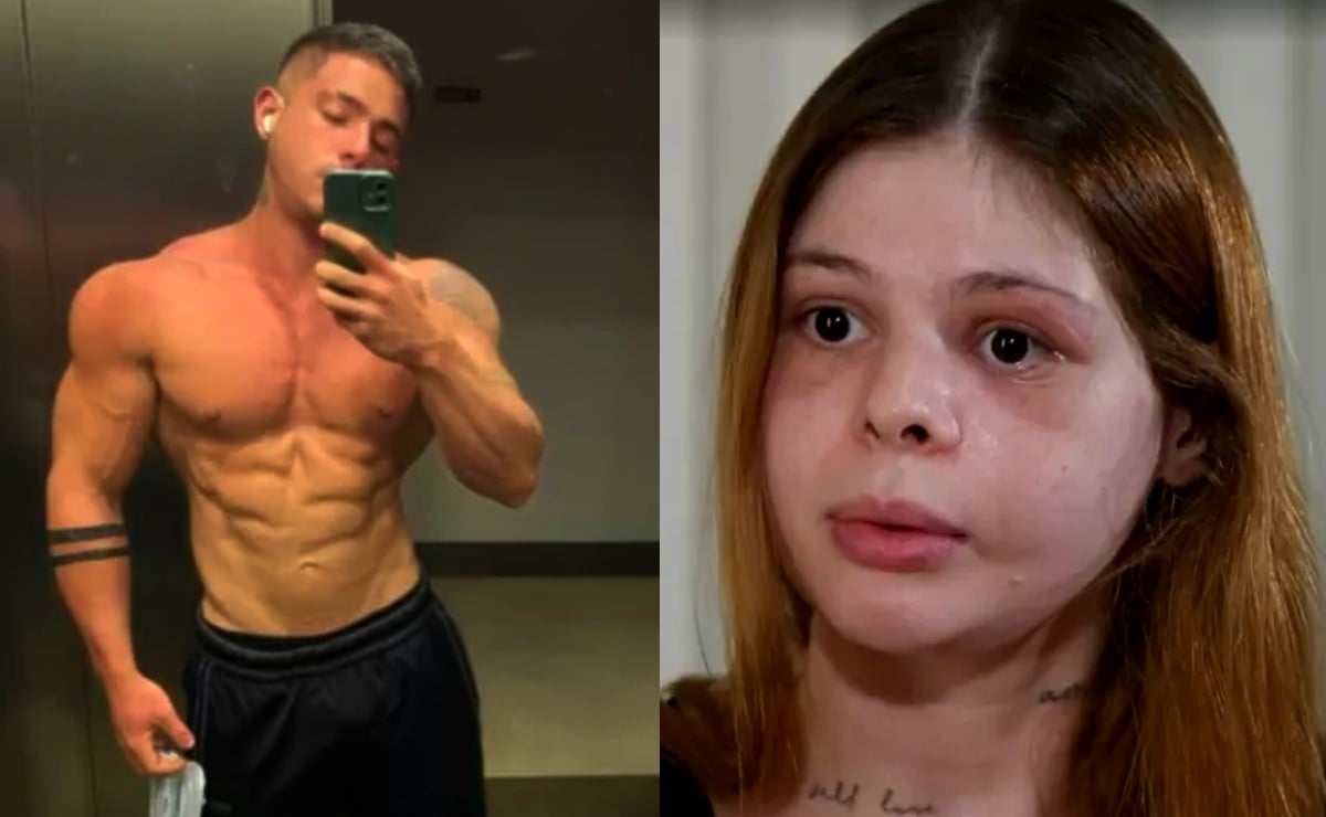 Médica agredida por ex-namorado ficou com rosto 'destruído' e cega