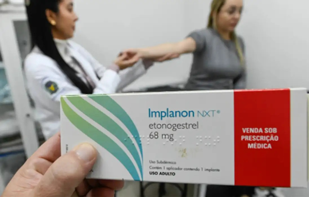 Implante contraceptivo se torna obrigatório em planos de saúde