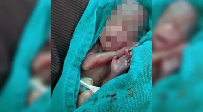Recém-nascido retirado do próprio velório no Acre morre após dois dias