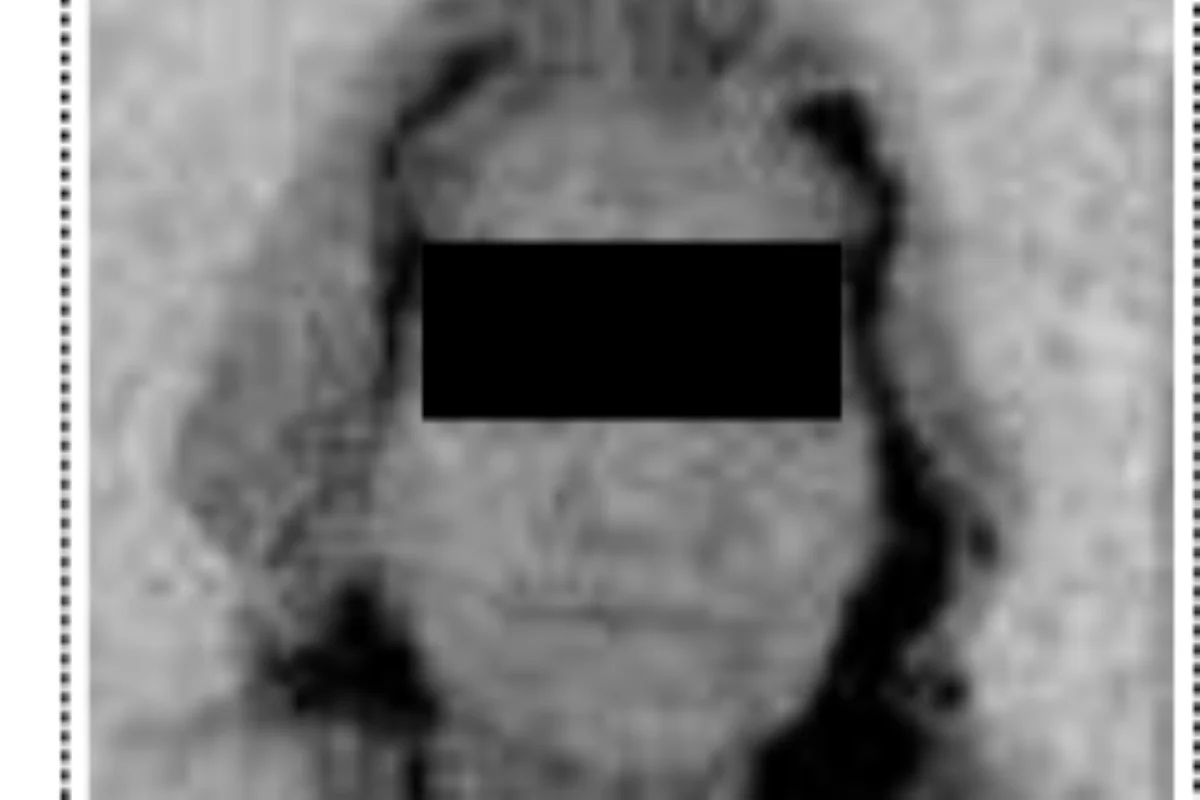 Entidades usaram fotos de RG para fraudar biometria do INSS