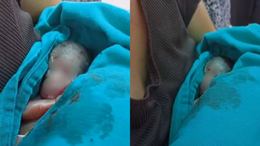 Morre recém-nascido prematuro que ressuscitou em velório no Acre