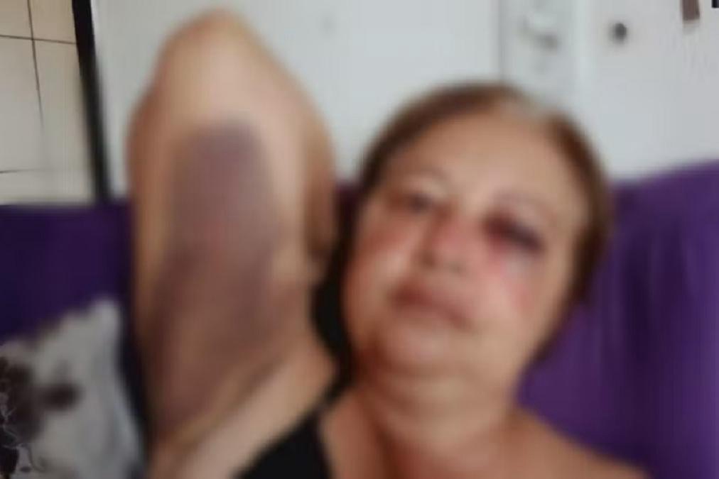 Servidora é exonerada após agredir moradora em Baliza; vítima diz ter sobrevivido “por milagre”
