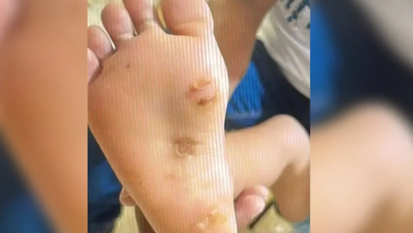Polícia prende casal após escola descobrir torturas de pais contra menina de 4 anos