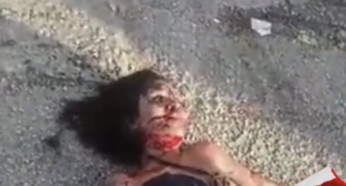 Vídeo: câmeras registram atropelamento de jovem pelo ex; vítima teve as pernas amputadas