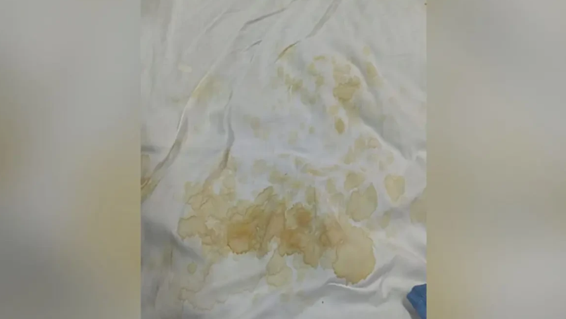Falta de lençóis deixa pacientes em leitos sujos no Hugol, em Goiânia