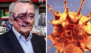 Cientista espanhol Mariano Barbacid pode ter descoberto cura para câncer de pâncreas