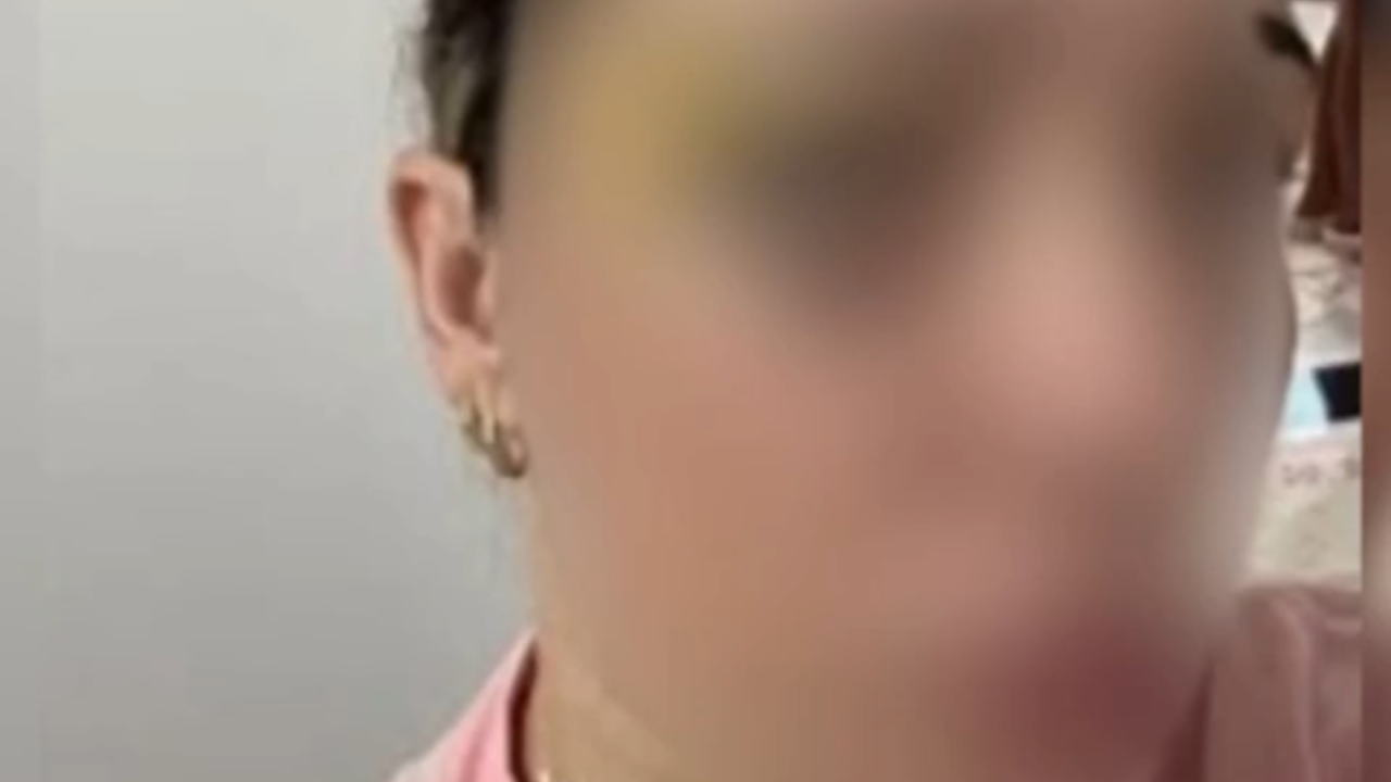 Vídeo: Mulher denuncia anos de violência em relacionamento abusivo em Anápolis