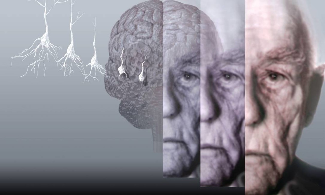 Alzheimer é a segunda doença mais temida pelos brasileiros, atrás apenas do câncer