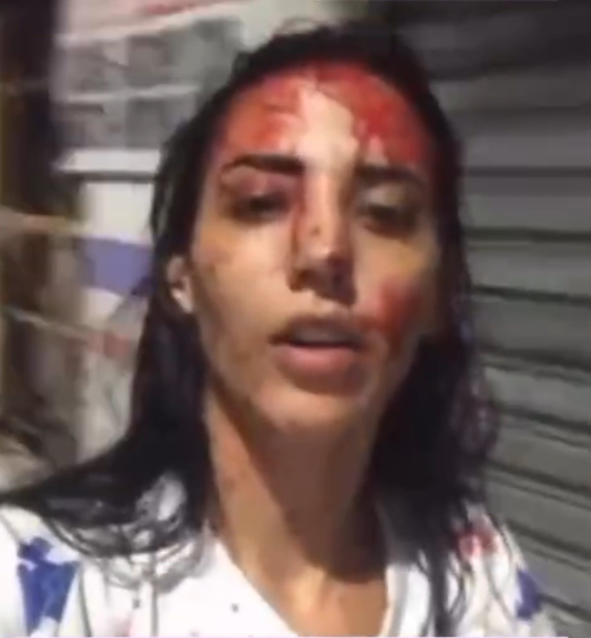 Mulher é detida após esfaquear companheiro e alega legítima defesa