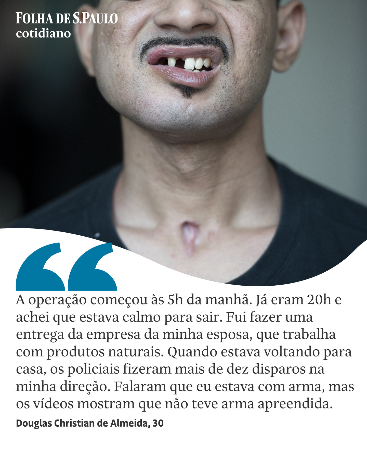 Homem baleado em operação no Rio acorda de coma e relata abuso policial