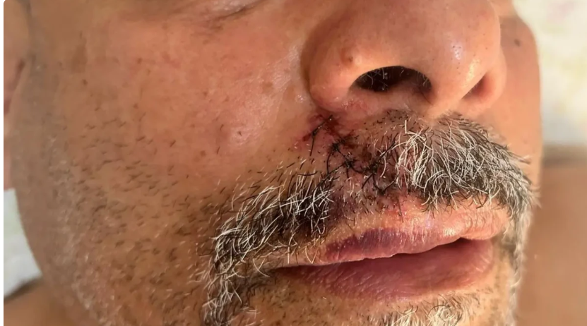 Ex-presidente do Vila Nova nega racismo, relata agressão e classifica acusação como caluniosa