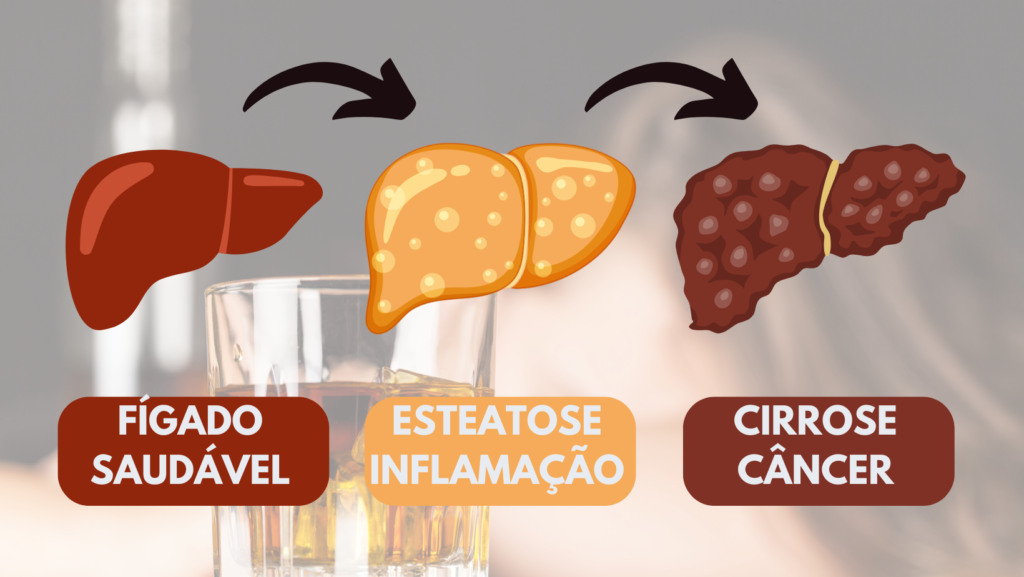 Doença hepática ligada ao álcool cresce e eleva mortes no Brasil